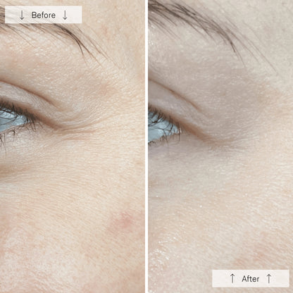 GlowVibe™ - LED Face Mask